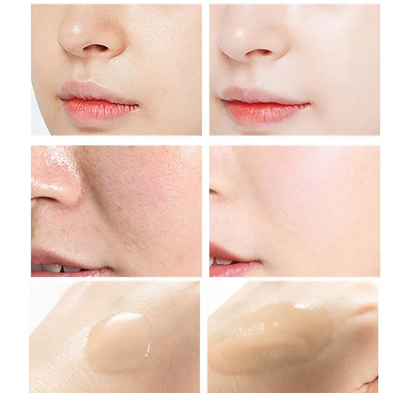 Peeling Serum Salicylic Acid F - Niacinamide Pore Shrinking Essence ulasan dan harga