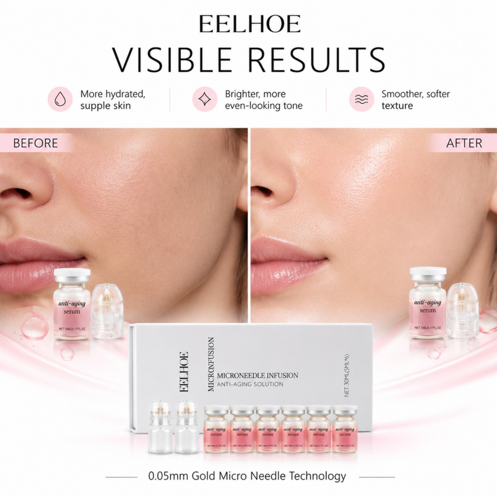 0.2mm Microneedle Serum Kit 6  - Hyaluronic Acid Facial Serum ulasan dan harga